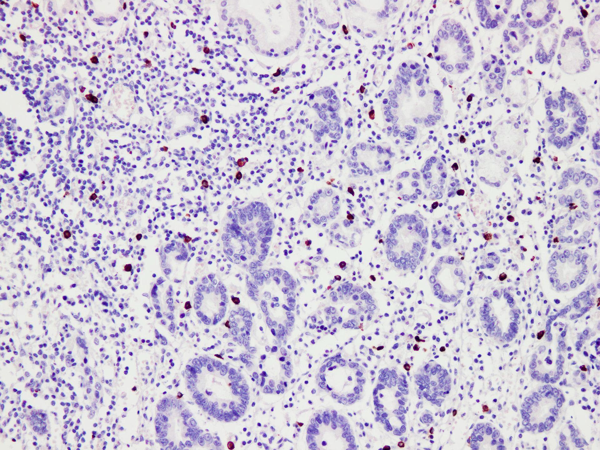 TPSAB1 / Mast Cell Tryptase Antibody
