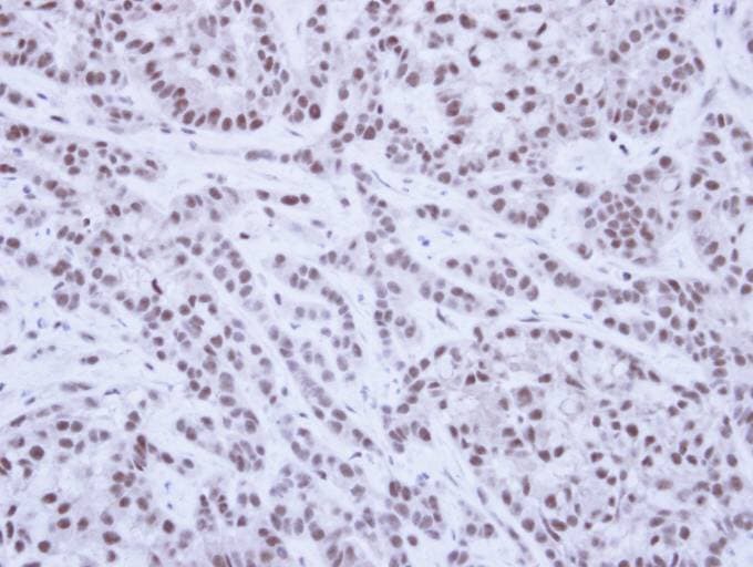 Polyclonal Rabbit anti-Human SAE1 Antibody (aa3-247, IHC, WB)