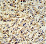 Polyclonal Rabbit anti-Human PRELP / Prolargin Antibody (aa119-148, IHC, WB)