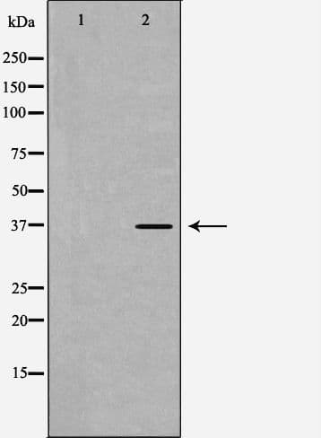 PPP1CB Antibody