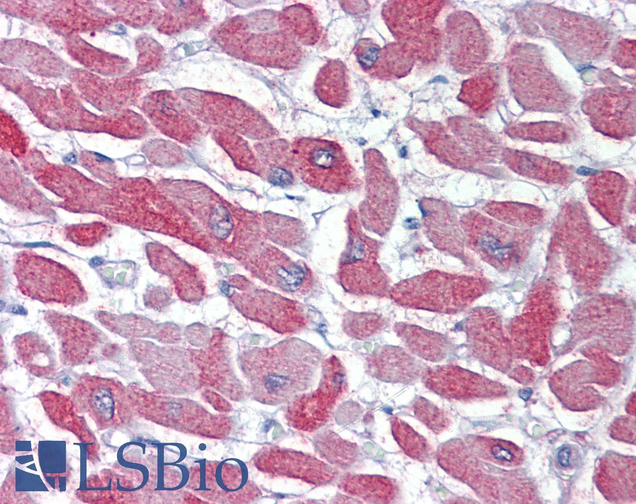 IHC-plus™ CRYAB / Alpha B Crystallin Antibody