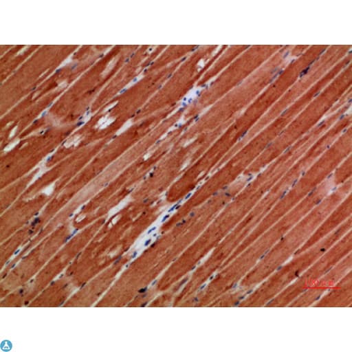 Polyclonal Rabbit anti-Human TTN / Titin Antibody (aa161-210, IHC)