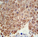 PHGDH Antibody (aa249-277)