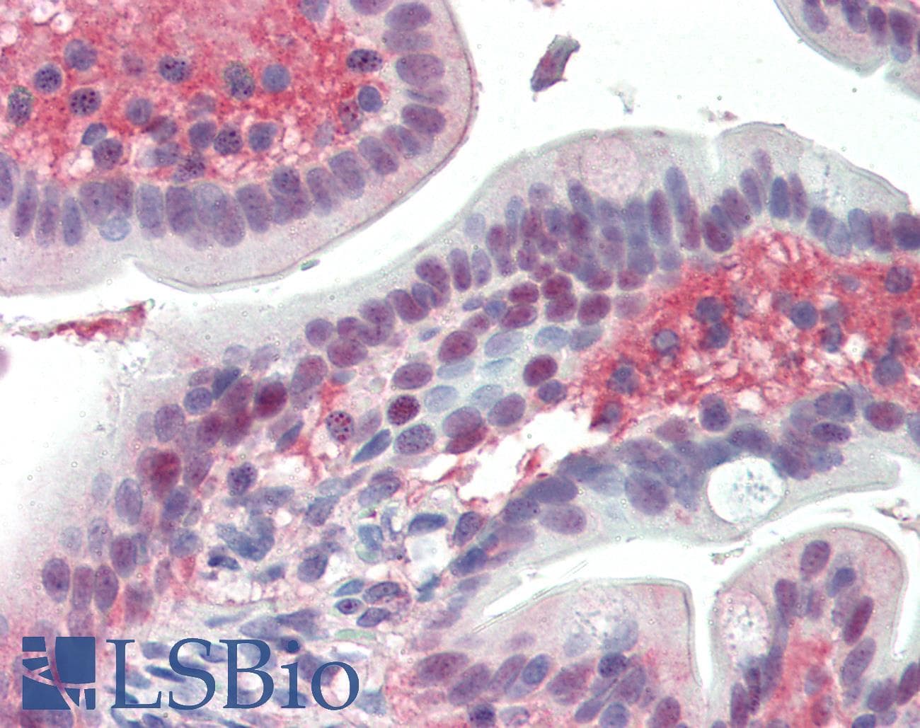 PathPlus™ Polyclonal Goat anti-Human EGR2 Antibody (aa239-251, IHC, WB)