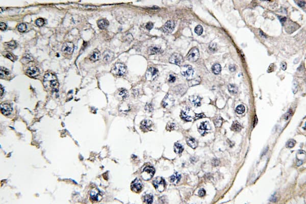 PI3K Alpha+Gamma Antibody (Tyr463)