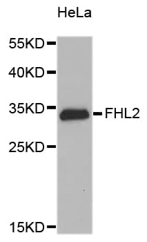 Polyclonal Rabbit anti-Human FHL2 Antibody (WB)