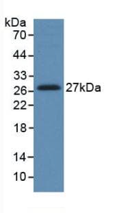 HGF / Hepatocyte Growth Factor Antibody (aa495-728)