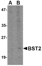 Polyclonal Rabbit anti-Human NANOS3 / NOS-3 Antibody (WB)