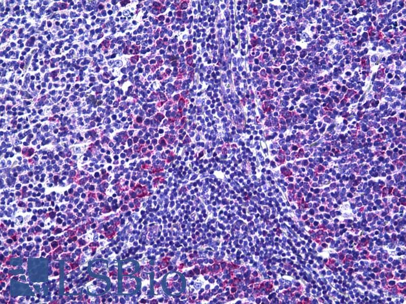IHC-plus™ Polyclonal Rabbit anti-Human FANCA Antibody (aa1121-1170, IHC)