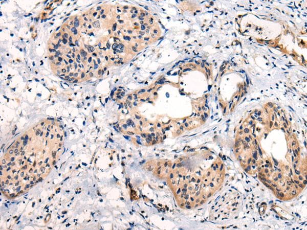 Polyclonal Rabbit anti-Human C16orf45 Antibody (IHC)