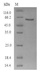 Human ADRB2 Protein (Recombinant 6His-SUMO, N-terminus)