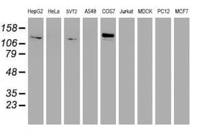 Monoclonal Mouse anti-Human ENPEP / Aminopeptidase A Antibody (clone OTI1D4, IHC, IF, WB)