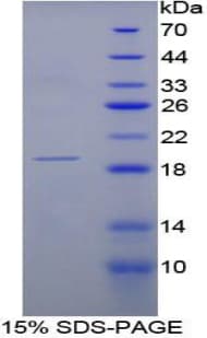 Rat RNASE3 Protein (Recombinant His-T7)