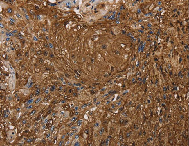 ITPR3 Antibody