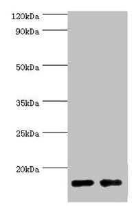 I-BABP / FABP6 Antibody (aa1-128)