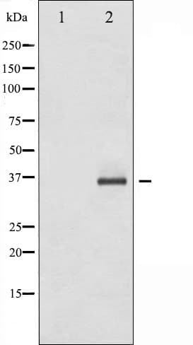 Polyclonal Rabbit anti-Human C/EBP Beta / CEBPB Antibody (phospho-Thr235,phospho-Thr188, IHC, IF, WB)