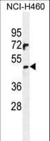 Polyclonal Rabbit anti-Human PRAMEF6 Antibody (aa395-423, IHC, IF, WB)