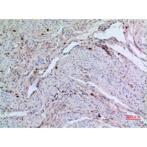 RFC1 / RFC Antibody (1071-1120 aa, C-terminal)