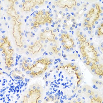 SRPX Antibody