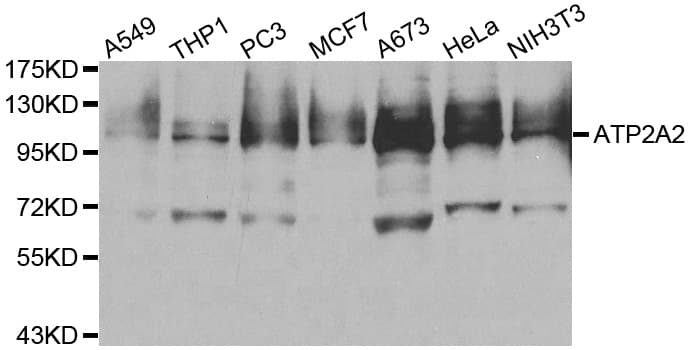 ATP2A2 / SERCA2 Antibody