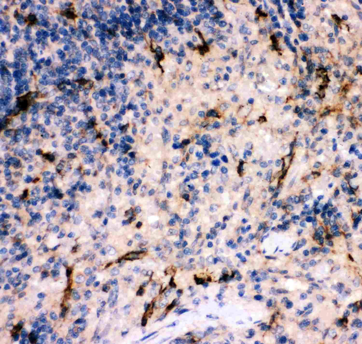 Polyclonal Rabbit anti-Rat Complement C5 Antibody (aa1-77, IHC, WB)