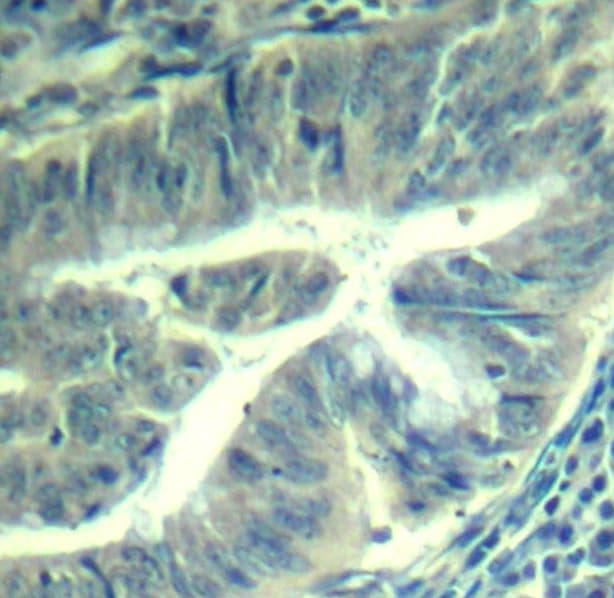 Polyclonal Rabbit anti-Human CDK6 Antibody (phospho-Tyr24, IHC, IF, WB)