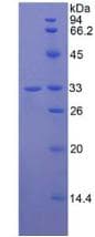 Human JAG2 / Jagged-2 Protein (Recombinant His-T7)