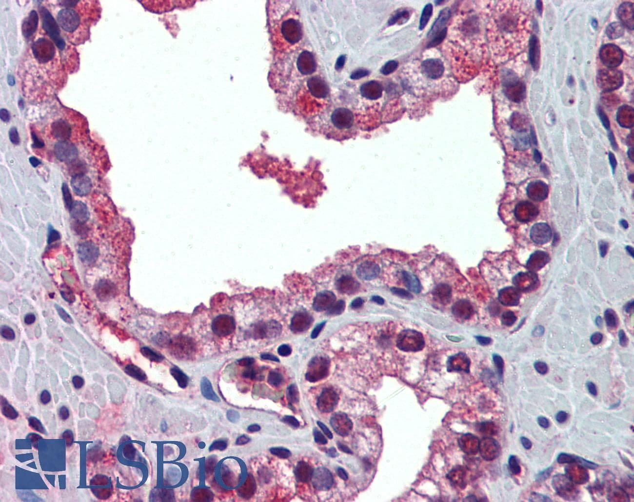 PABPN1 / PABP2 Antibody (N-Terminus)