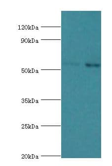 Polyclonal Rabbit anti-Human IL7R / CD127 Antibody (aa21-239, IHC, WB)