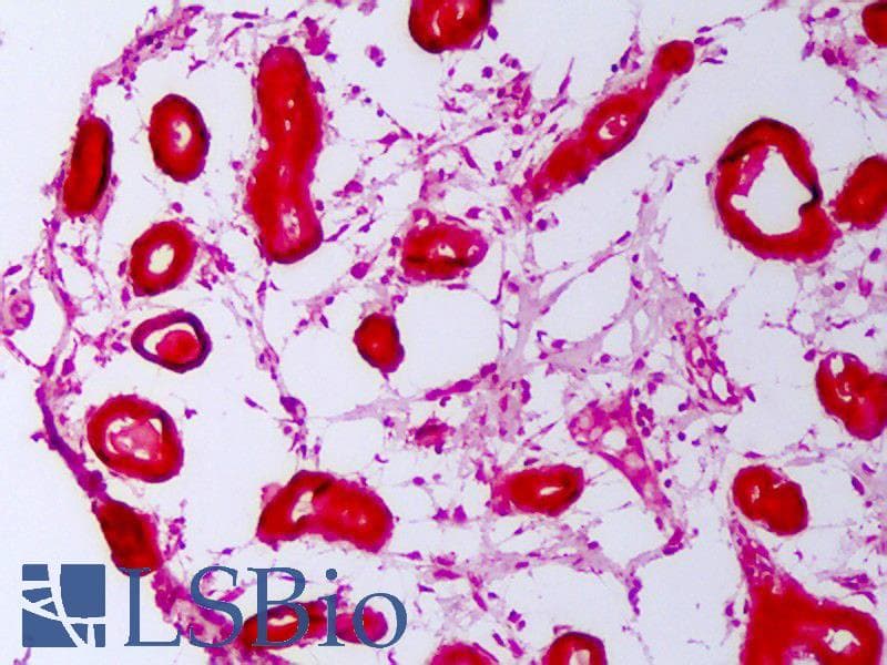IHC-plus™ HSPH1 / HSP105 Antibody