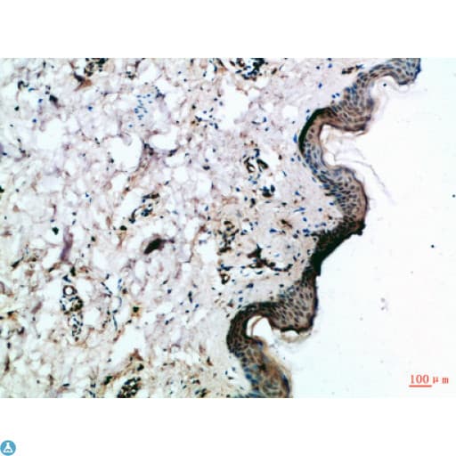 FZD4 / Frizzled 4 Antibody