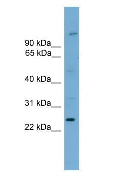HOXB7 Antibody (aa101-150)