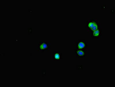 BUB1B / BubR1 Antibody (aa230-394)