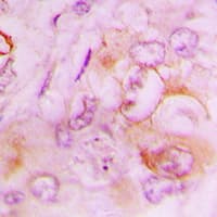 SERPINB9 / PI9 Antibody (Internal)
