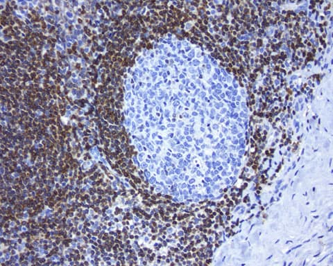 BCL2 / Bcl-2 Antibody (clone UMAB225)