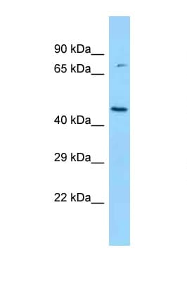 Polyclonal Rabbit anti-Rat BCKDK Antibody (N-Terminus, WB)