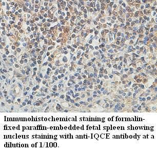 IQCE Antibody (aa385-545)