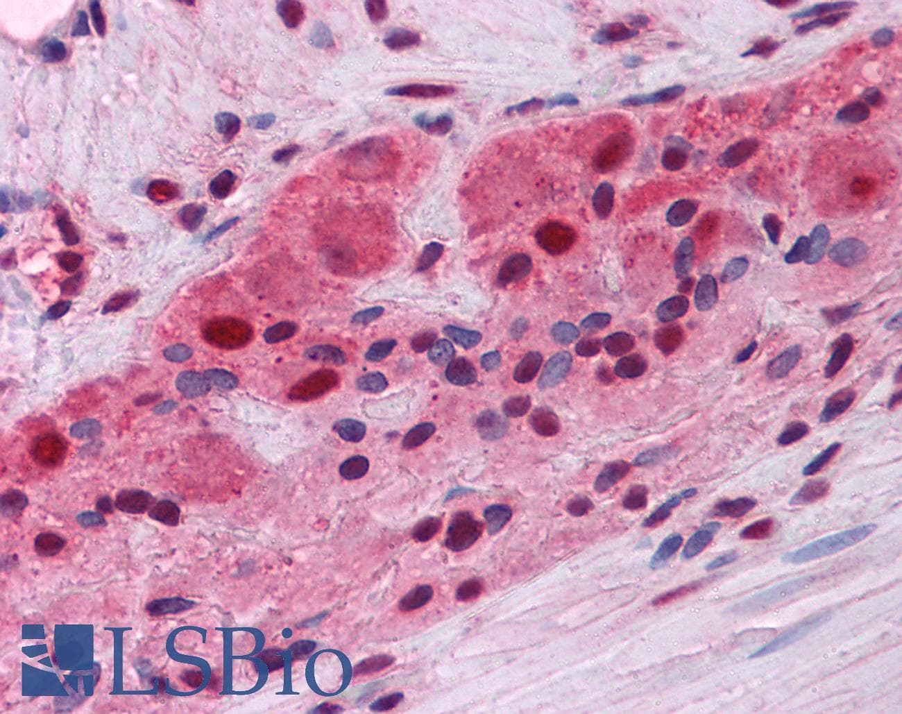 IHC-plus™ MUM1 Antibody (clone 4G10)