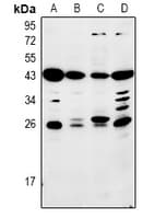Polyclonal Rabbit anti-Human MBL2 / Mannose Binding Protein Antibody (WB)