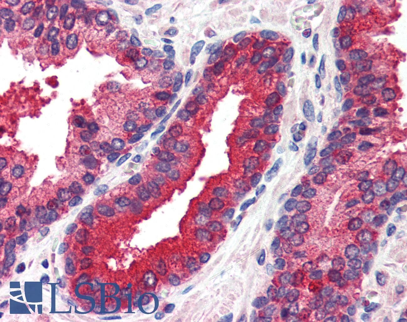 IHC-plus™ EIF2AK2 / PKR Antibody