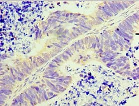 GLYATL1 Antibody (aa1-302)
