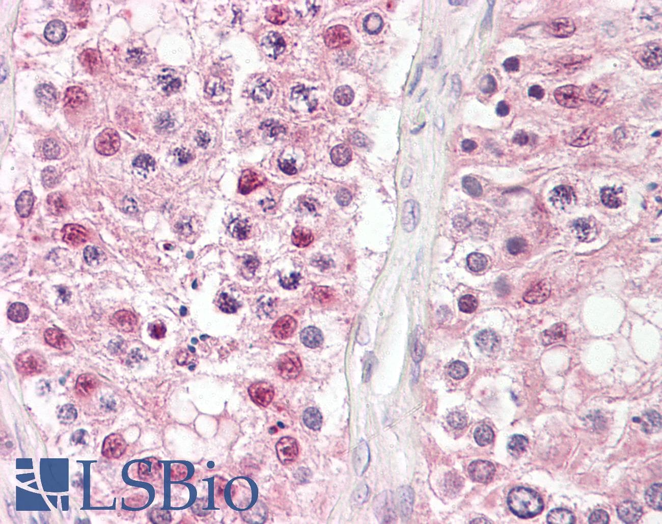 IHC-plus™ CSNK2A1 Antibody