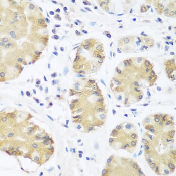 Polyclonal Rabbit anti-Human TRH / Thyrotropin Releasing Hormone Antibody (IHC, WB)