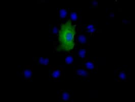 EPHX2 / Epoxide Hydrolase 2 Antibody (clone OTI2G2)