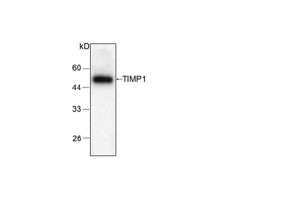 Monoclonal Mouse anti-Human TIMP1 Antibody (clone 6, WB)