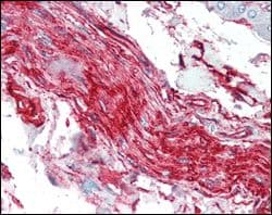 S100A10 Antibody (clone 4E7E10)