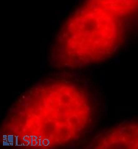 DDX17 Antibody