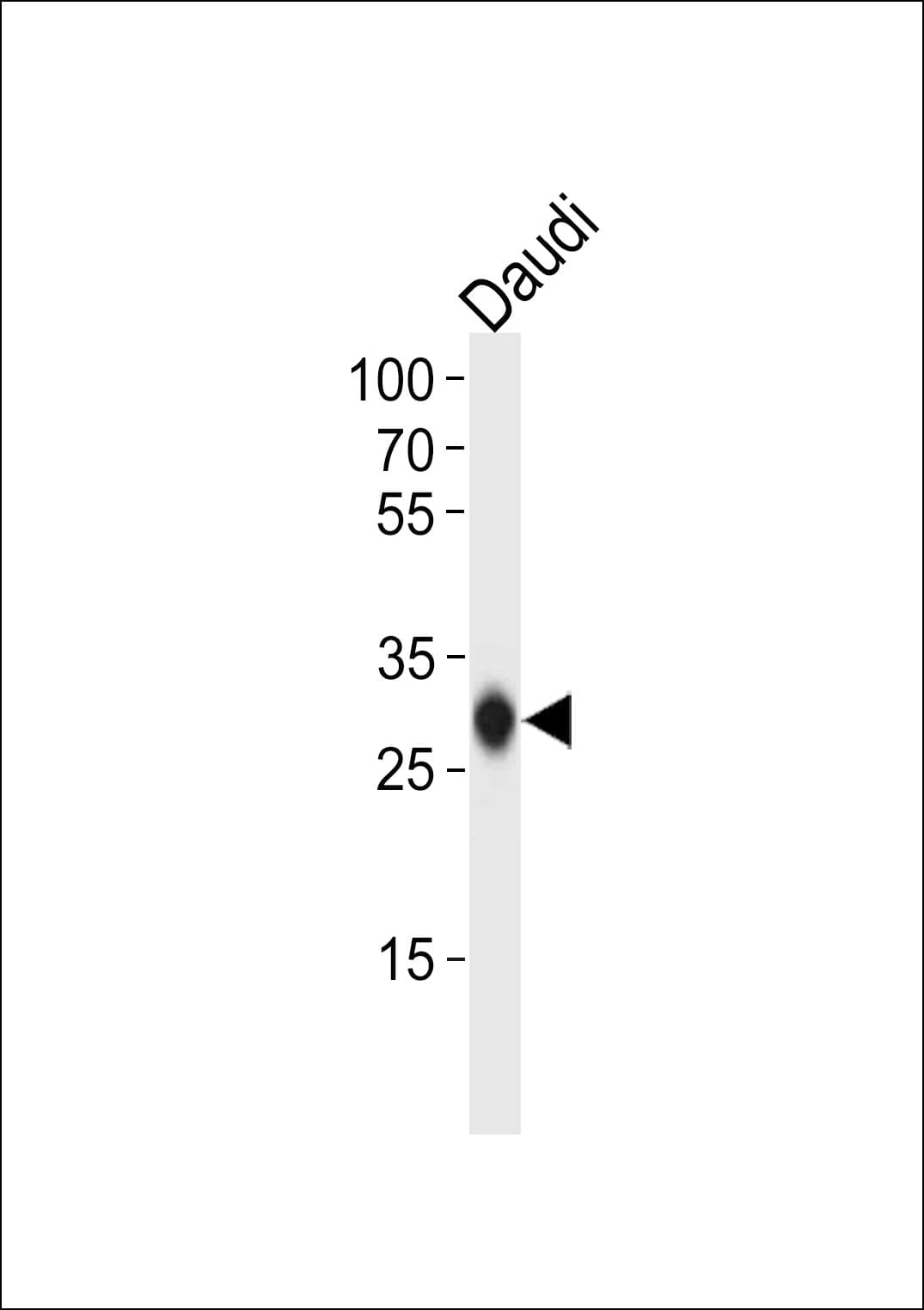 Polyclonal Rabbit anti-Human HLA-DQB1 Antibody (aa13-39, WB)