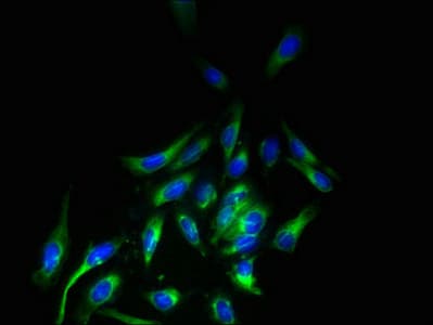 Polyclonal Rabbit anti-Human LRRC3B Antibody (IHC)