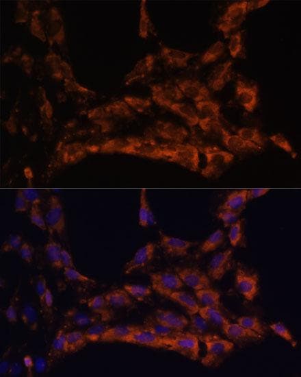 IL18 Antibody